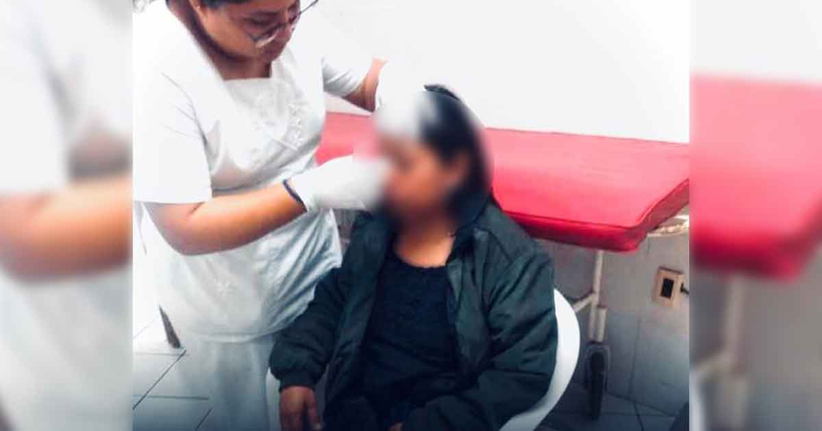 Albañil casi le corta la nariz a mordidas a su ex esposa