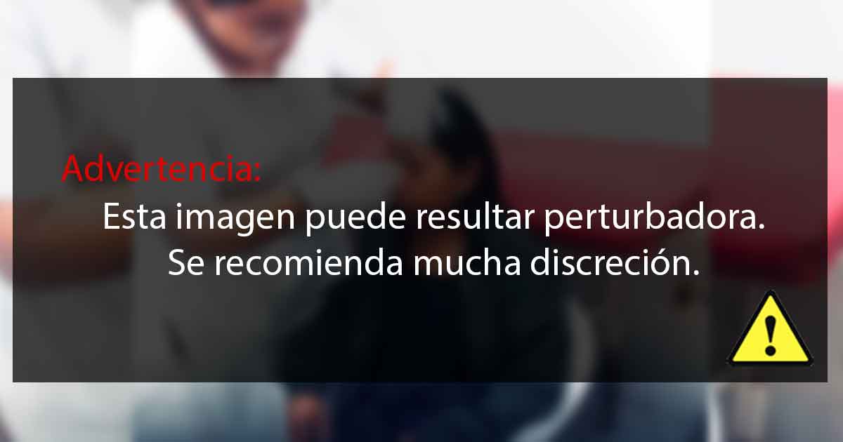 Albañil casi le corta la nariz a mordidas a su ex esposa