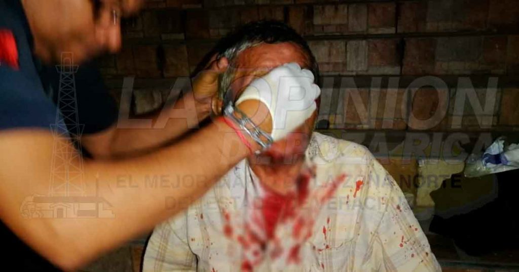 Se rompe la nariz al caer al suelo en Papantla