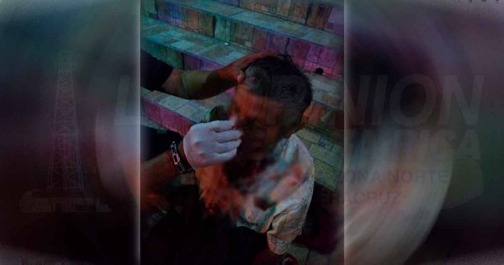 Se rompe la nariz al caer al suelo en Papantla