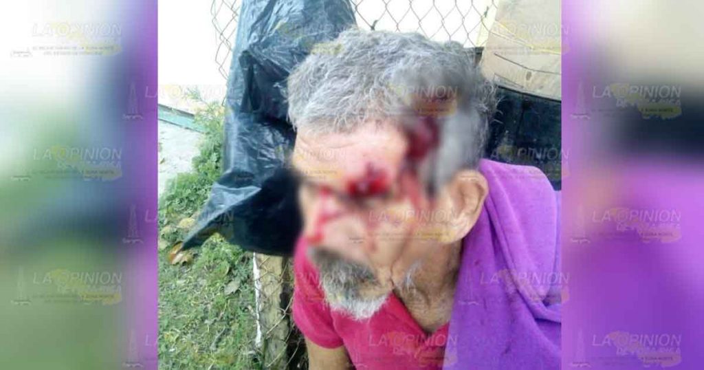 Atropellan a comerciante de Chinampa