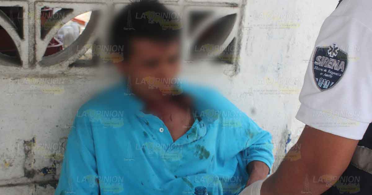 Jornalero recibe una golpiza al ser asaltado