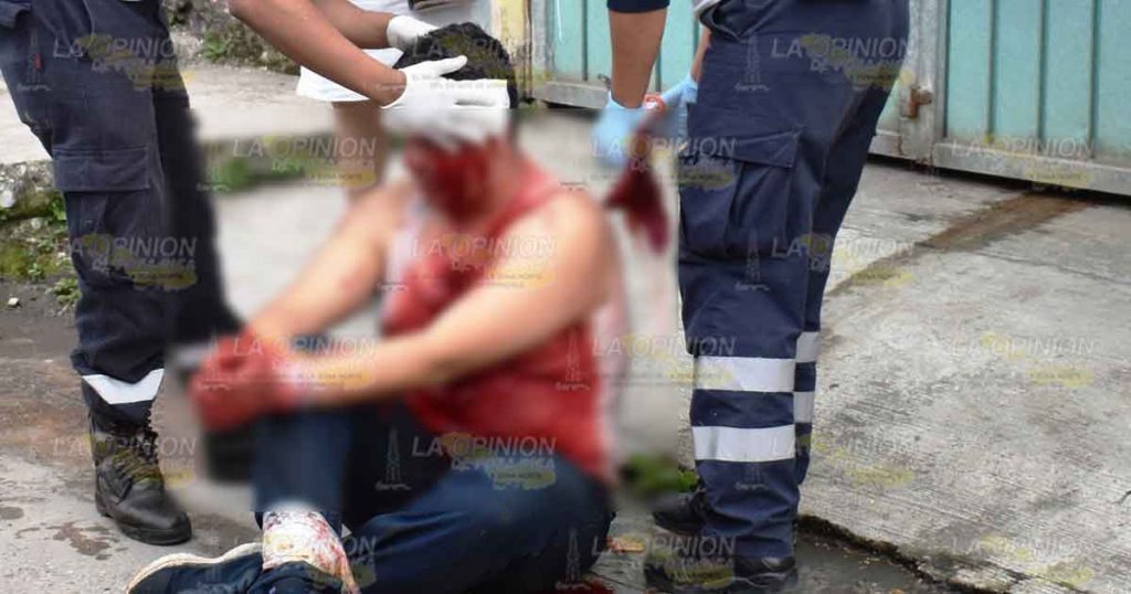 Lo linchan y dejan amarrado en calles de Tlapacoyan