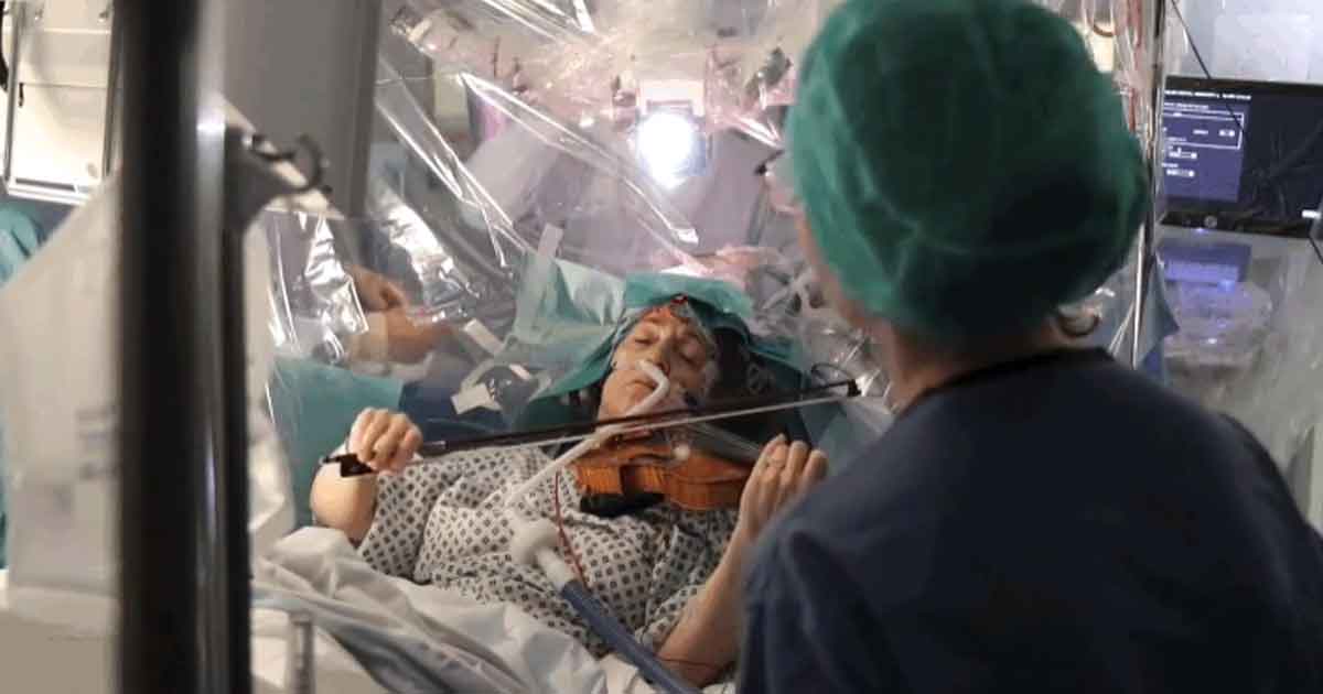 Una mujer toca el violín mientras le realizan una cirugía para eliminar un tumor cerebral (Video)