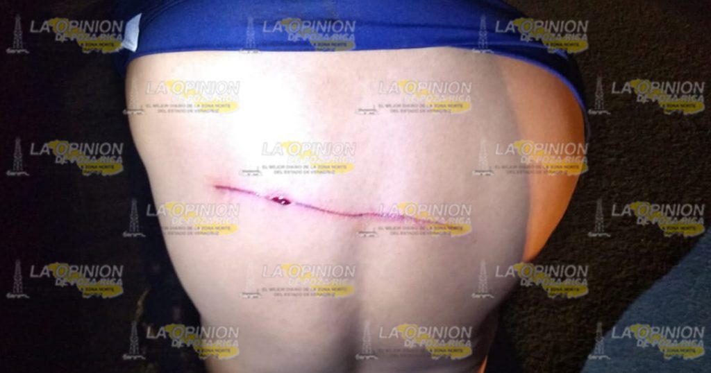 Lo agarran a machetazos