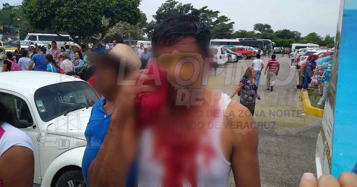 Derechos Humanos abre expediente por agresión de policías a campesinos
