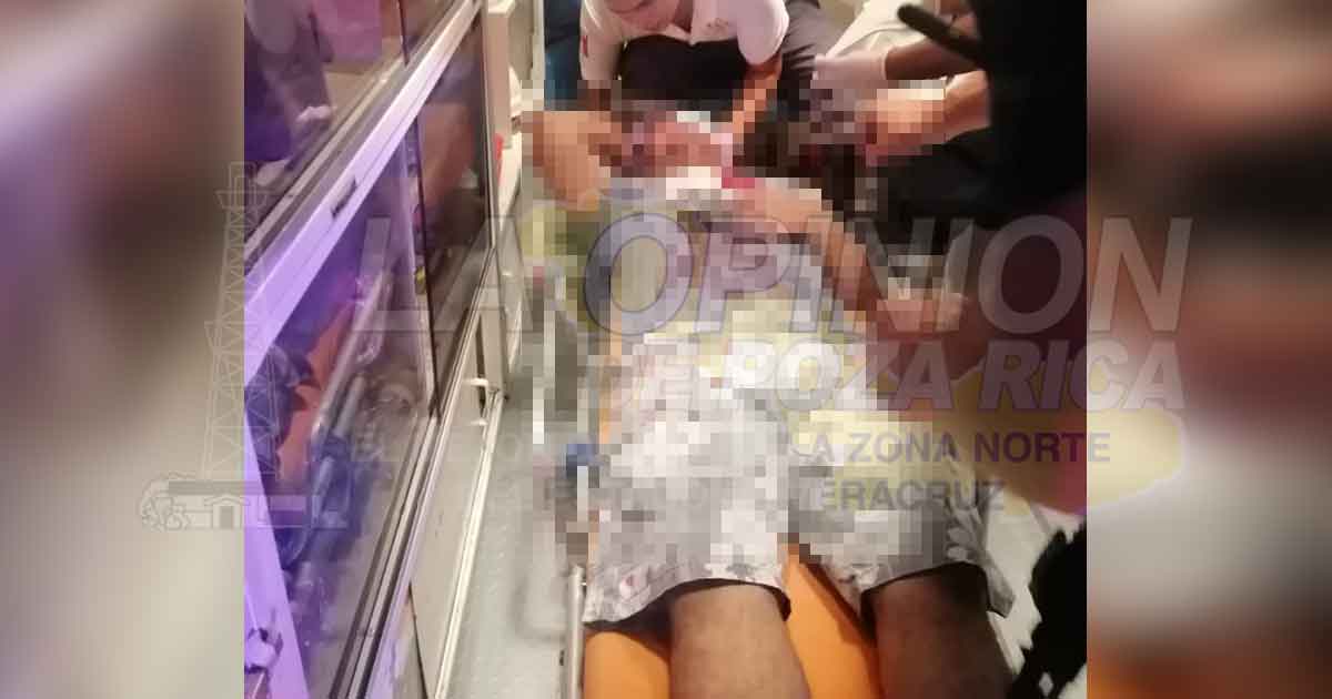 Quería tumbar el distribuidor vial