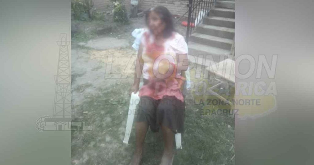 ¡Brutal golpiza a indefensa mujer! de Cazones de Herrera