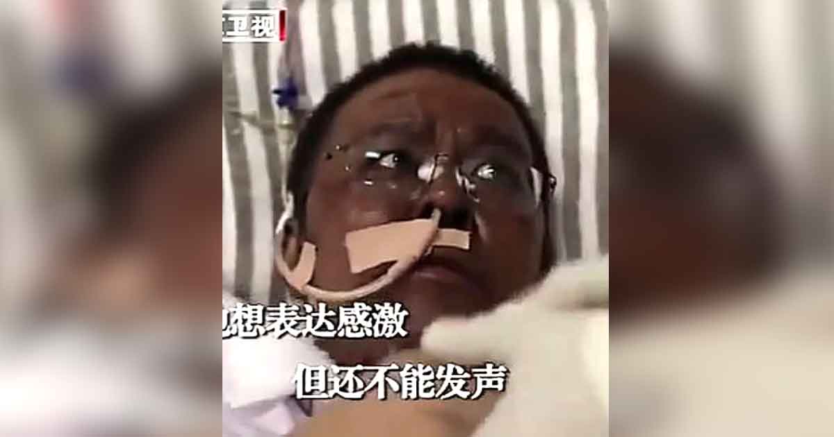 Dos médicos chinos despiertan con la piel de color negro tras recuperarse del virus