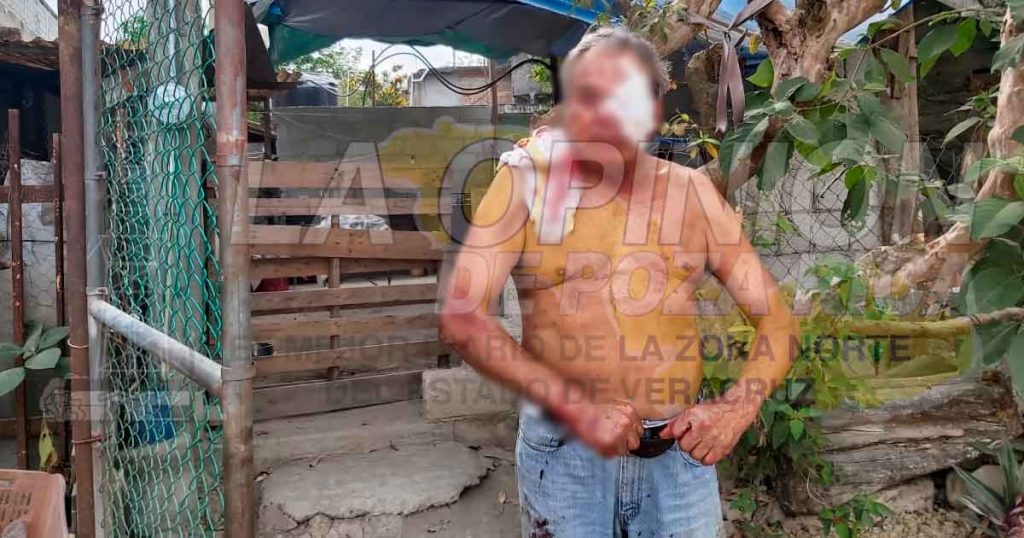 Lo golpean para robarle en la colonia Independencia en Poza Rica