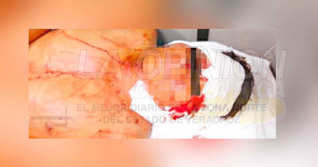 Lo golpearon y le arrancaron la oreja