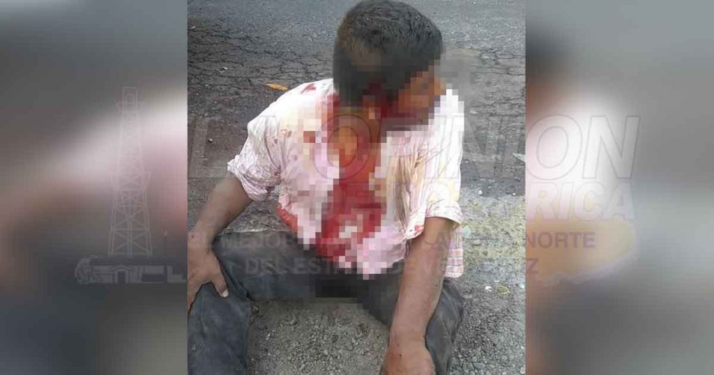 ¡Cruento encontronazo; tres lesionados!