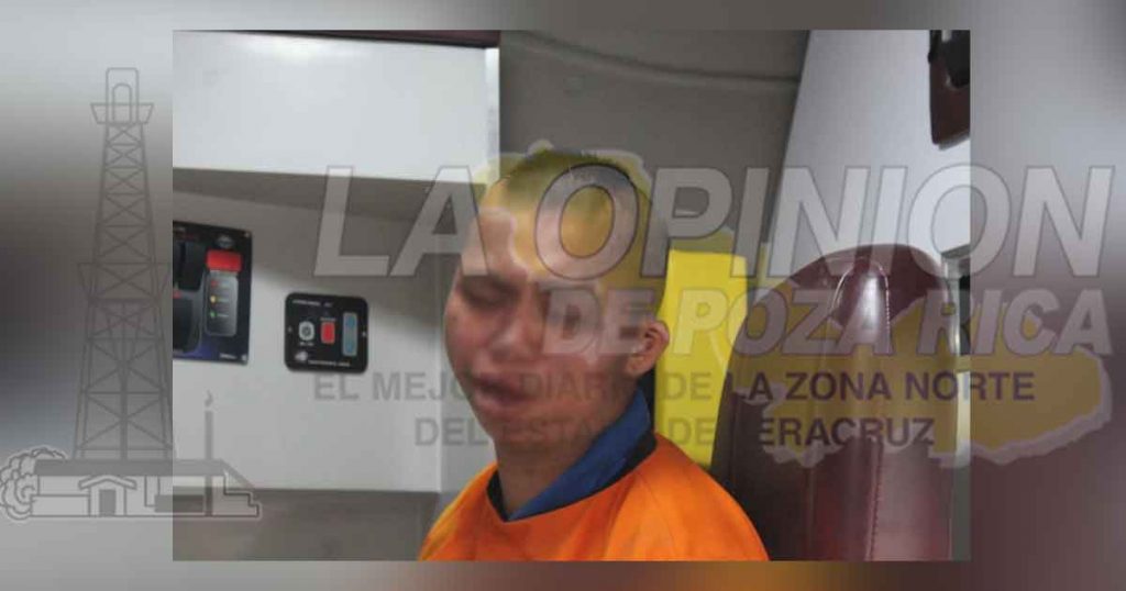 Se golpea el rostro en el pavimento tras caer de su propia altura