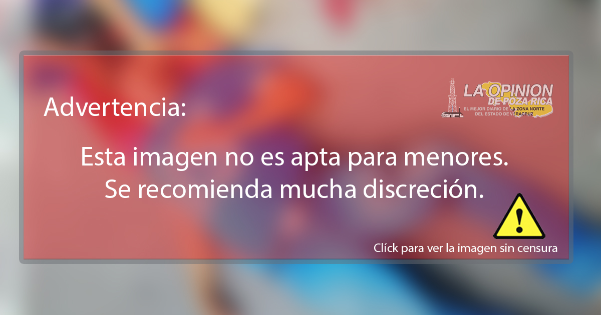 Lo atropellaron hace más un mes, y el responsable se niega cubrir gastos médicos