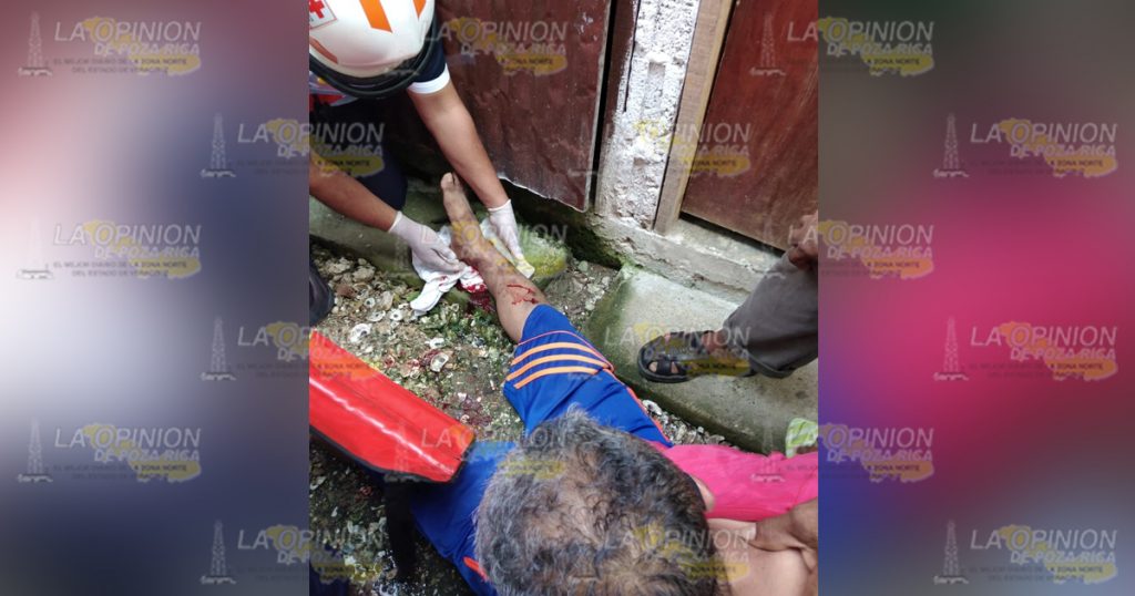 ¡Se fractura tobillo en aparatosa caída!