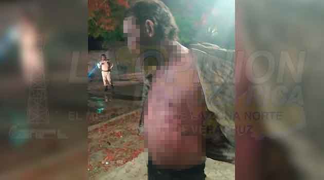 Le prende fuego a “su amigo”, andaban de parranda