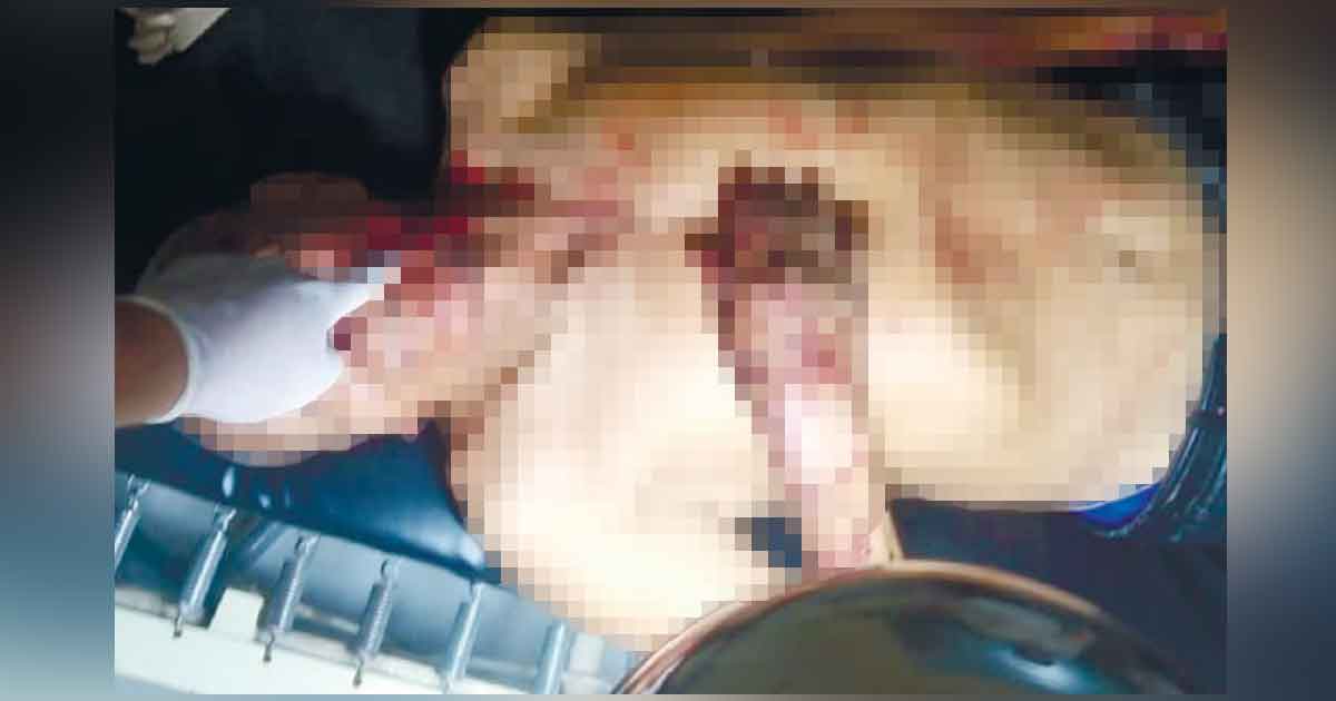 Hijo de ex candidata de MORENA golpea y deja inconsciente a su pareja