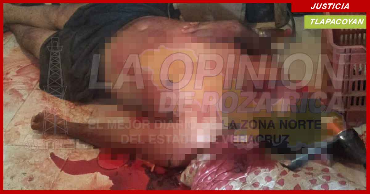 Se dio un tiro en el rostro al limpiar su arma, en Tlapacoyan