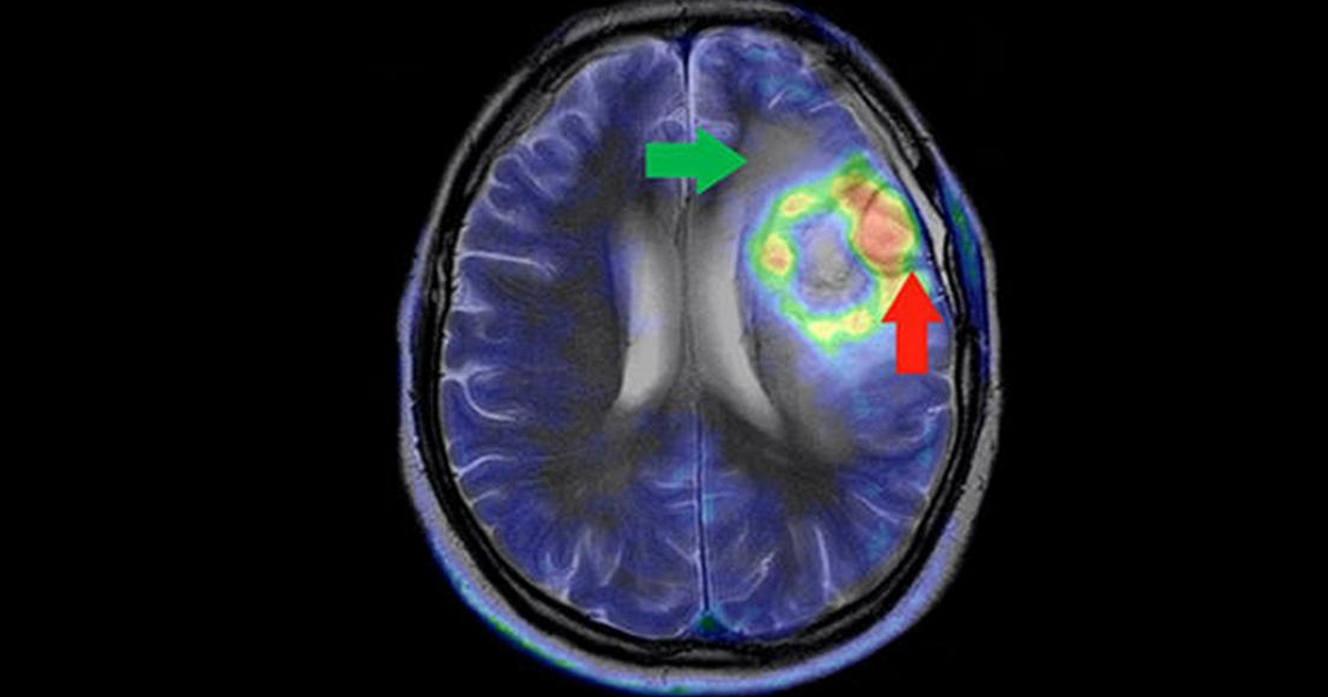 Aprendizaje federado, la técnica de IA para proteger la privacidad