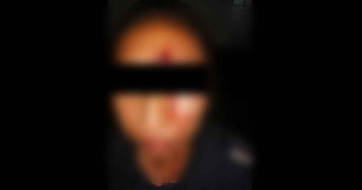 Lesionan en trifulca a una mujer policía