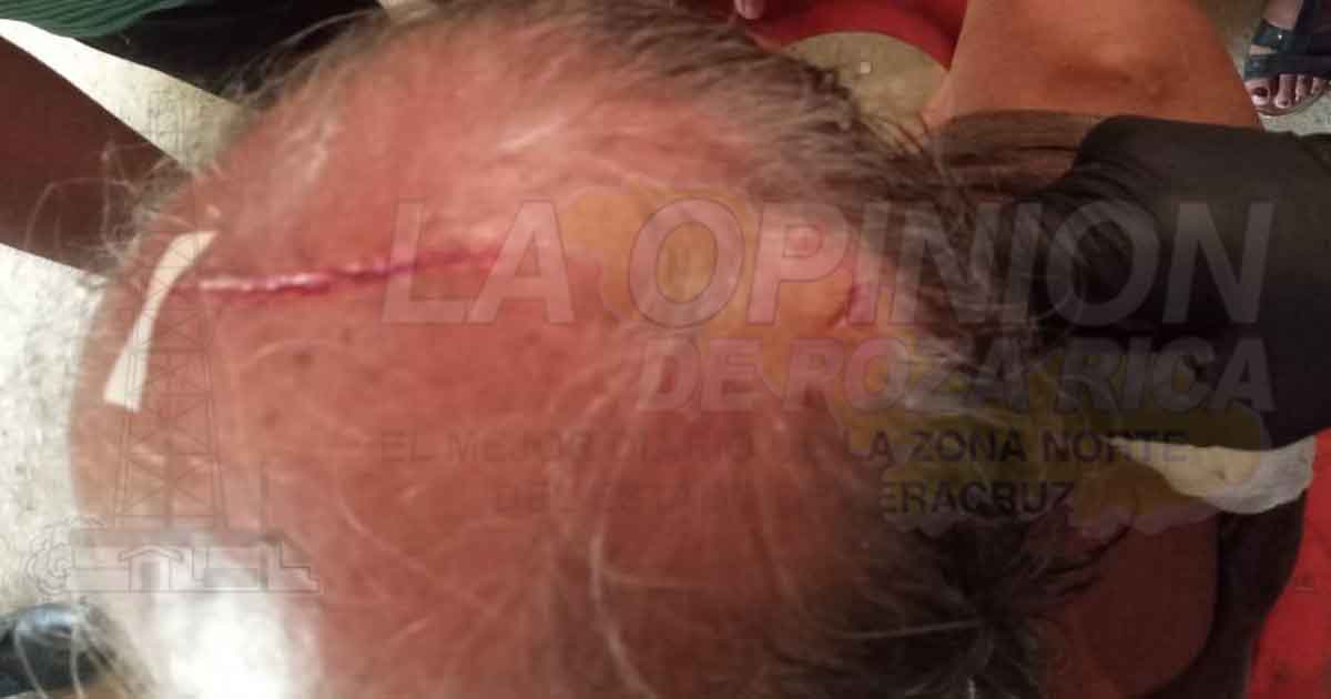 ¡Se parte la cabeza! Estaba alcoholizado