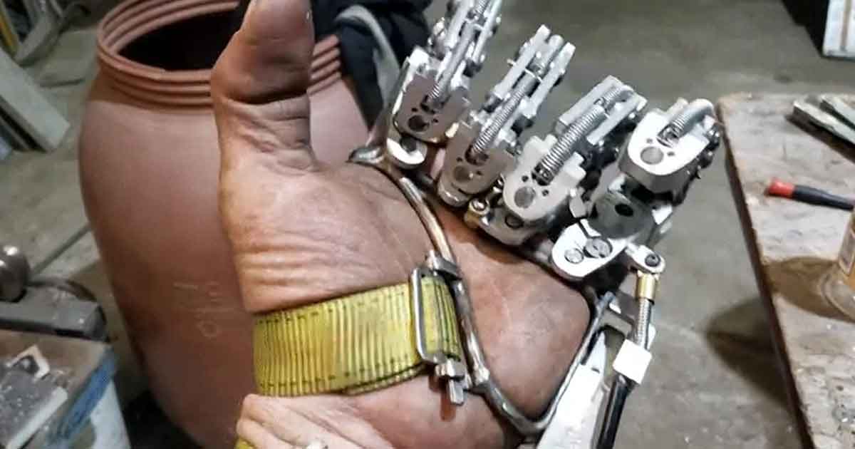 Construye una prótesis de dedos articulados que no necesita baterías