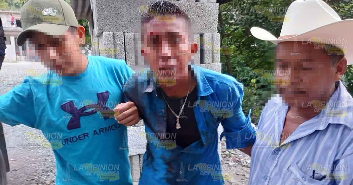 Le dejan la frente como alcancía en riña entre parientes, en Calalco, Coyutla