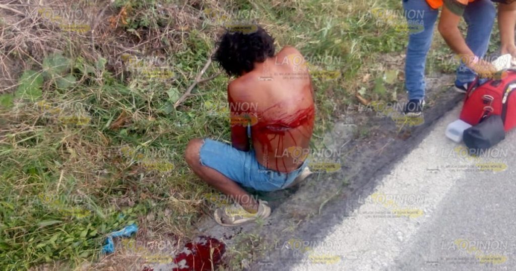 Atropellan a un hombre, el responsbale se dio a la fuga