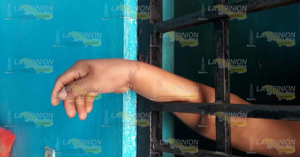 ¡Amarran a carpintero!