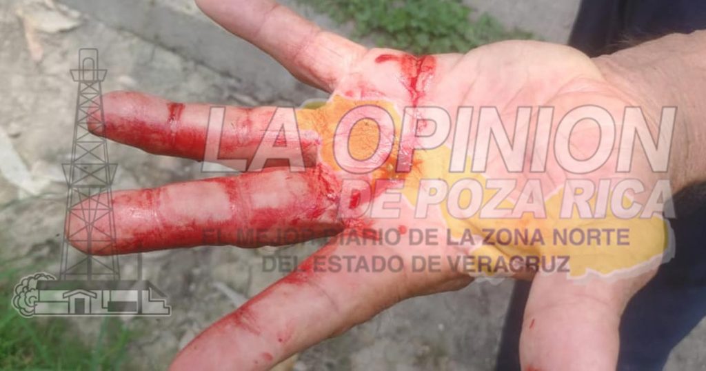 Padre e hijo, golpeados