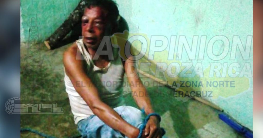 Quiso matar a su ex pareja enTlapacoyan