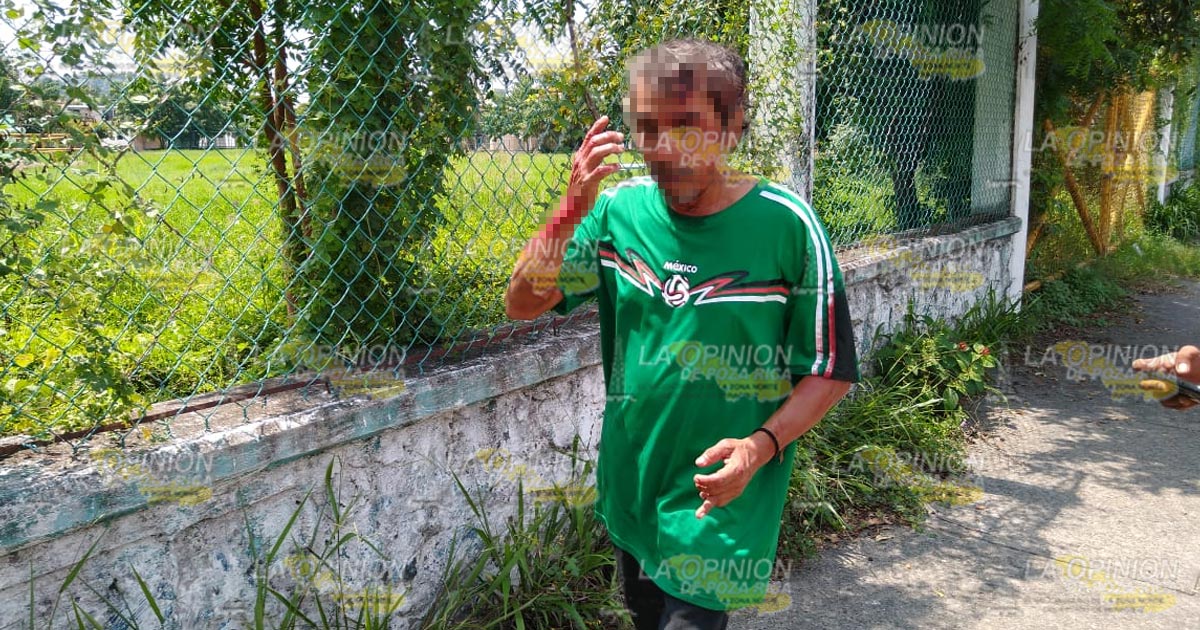 Se parte la frente al caer a alcantarilla