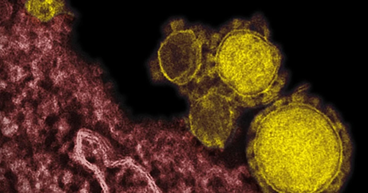 Luz ultravioleta mata al coronavirus sin dañar a personas: estudio