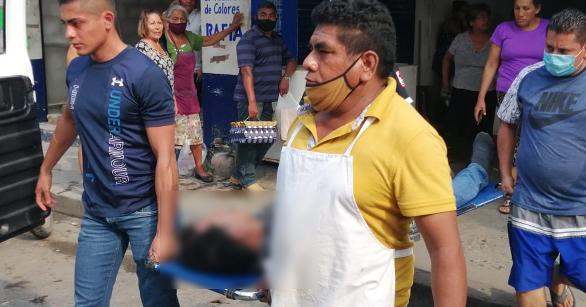 Empleado sufrió quemaduras