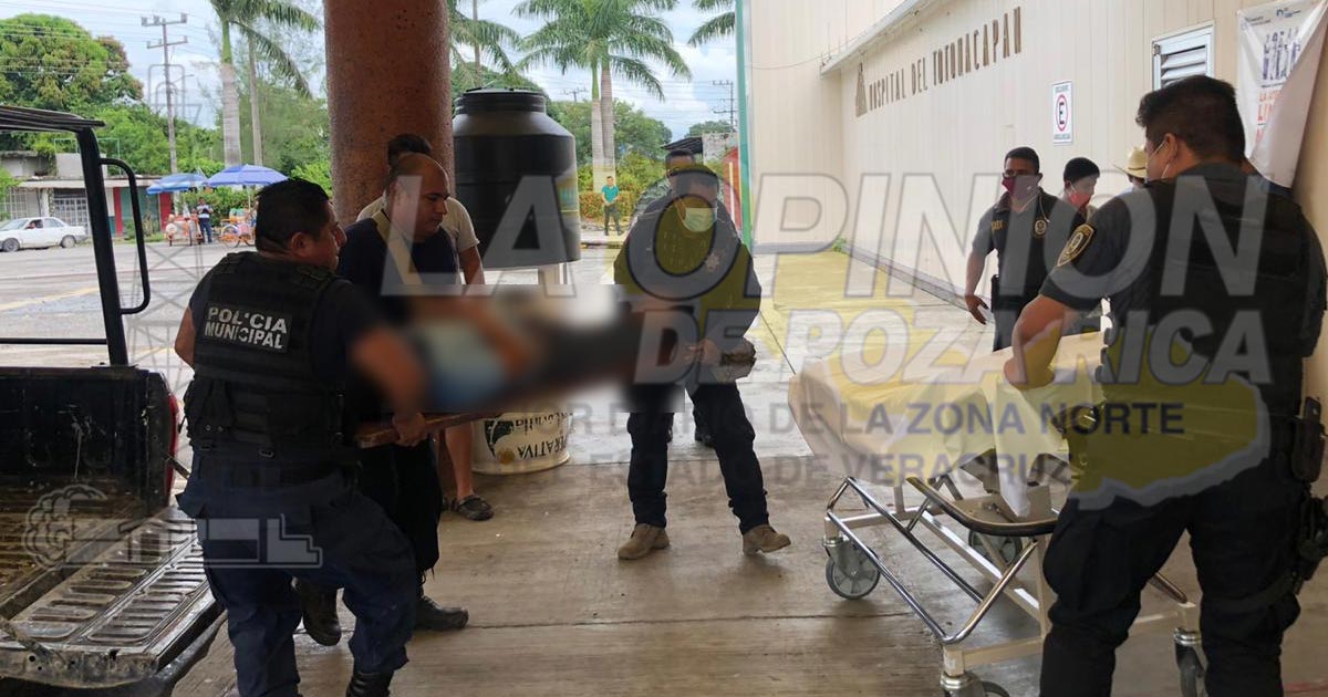 Arrollado por un camión de volteo