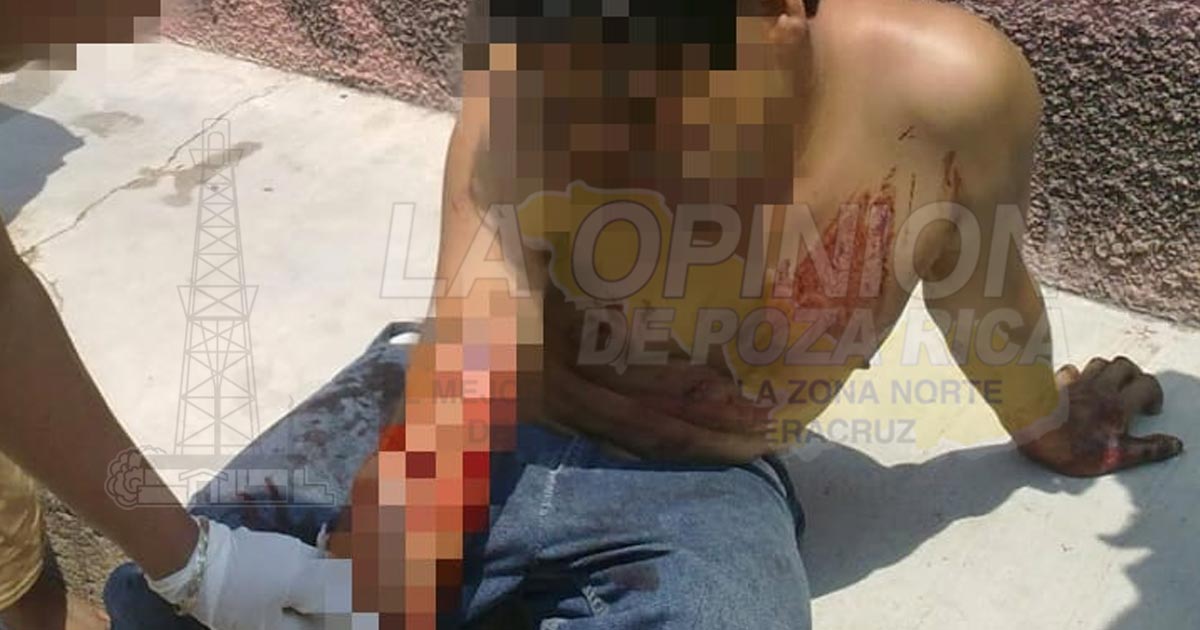 Herido con una varilla