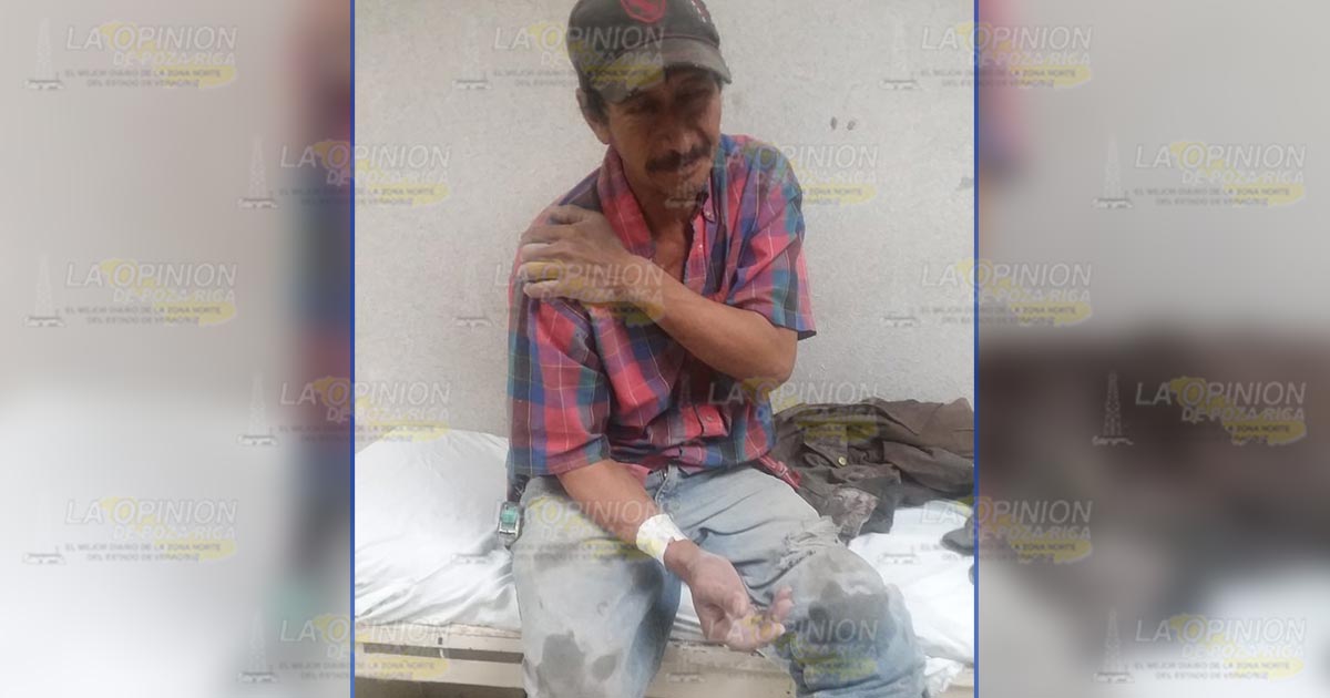 Albañil cae de azotea y se rompe el tobillo