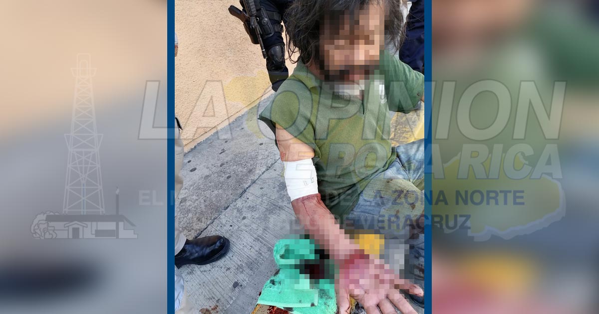 Integrante del escuadrón de la muerte herido por arma blanca