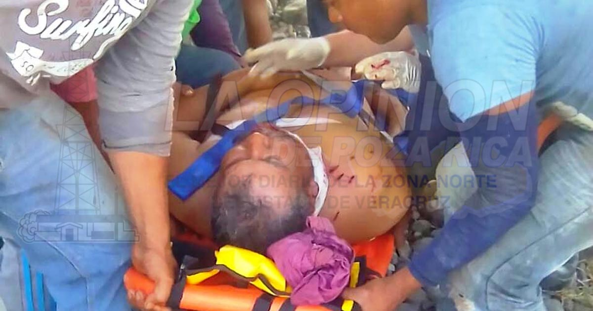 Le dieron un escopetazo en Misantla