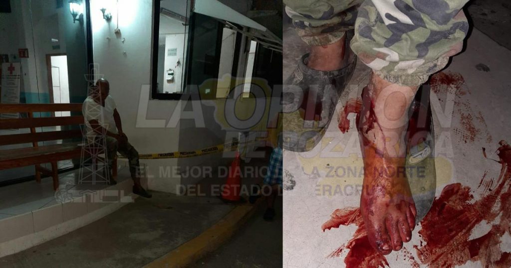 Cae de moto y se fractura un tobillo