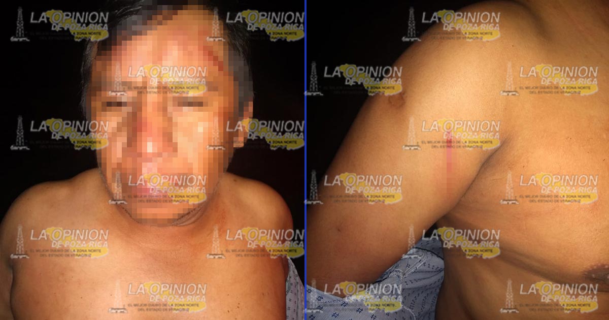 Los agreden a machetazos