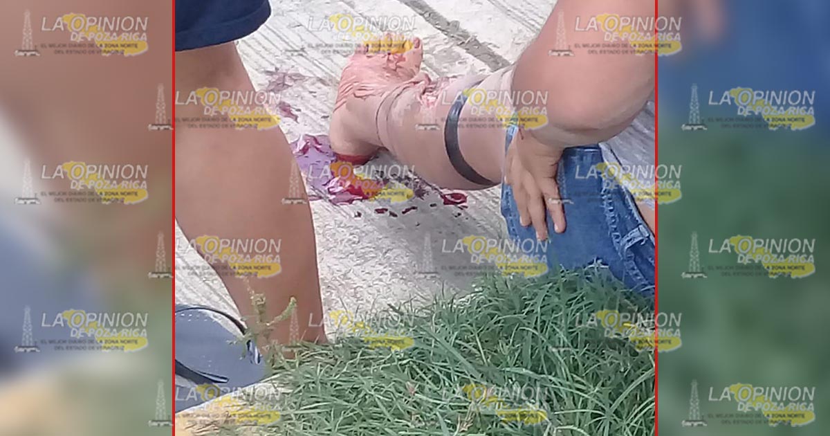 Pick-up embiste a una motociclista