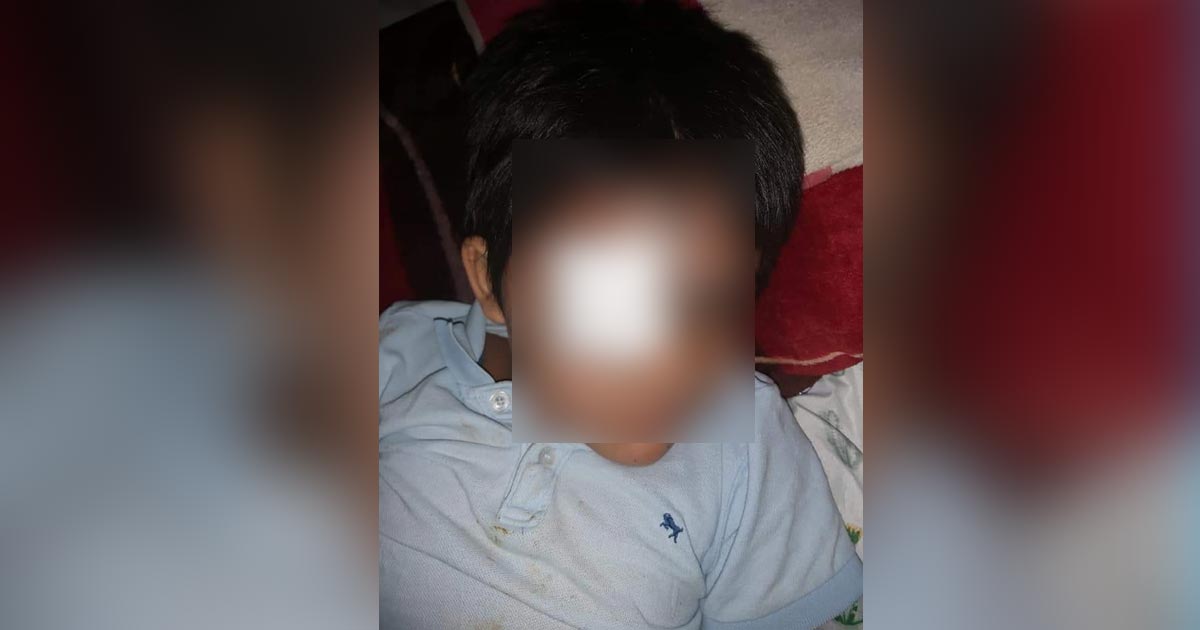 Menor corre riesgo de perder el ojo