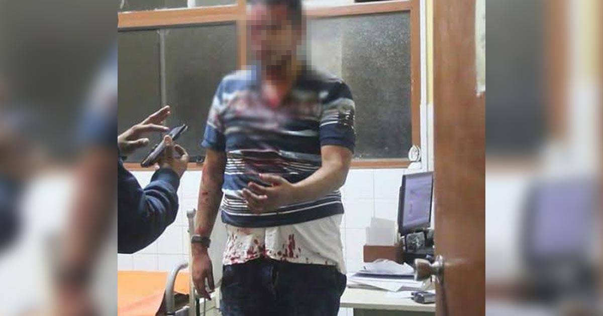Herido de un botellazo al participar en una riña
