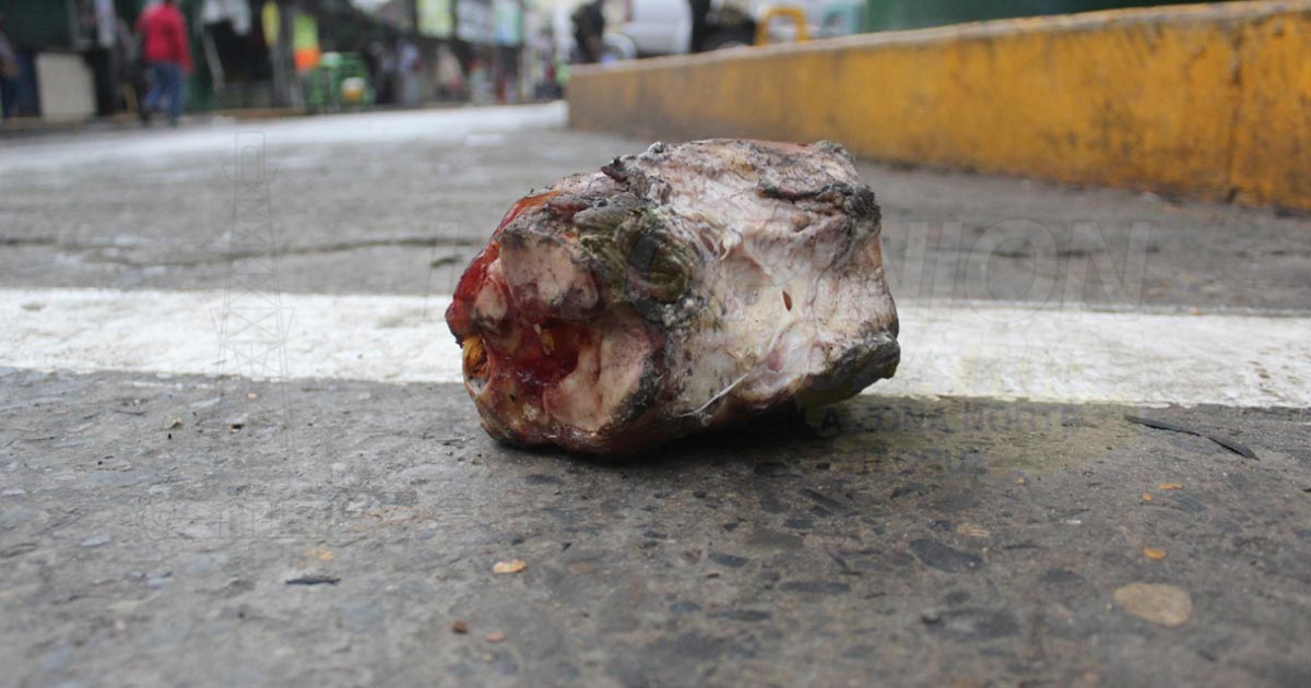 Foco de infección en pleno centro