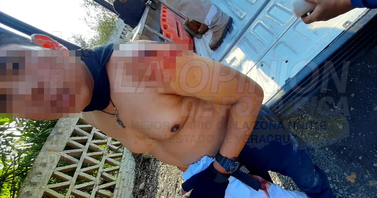 Policía municipal recibe machetazo