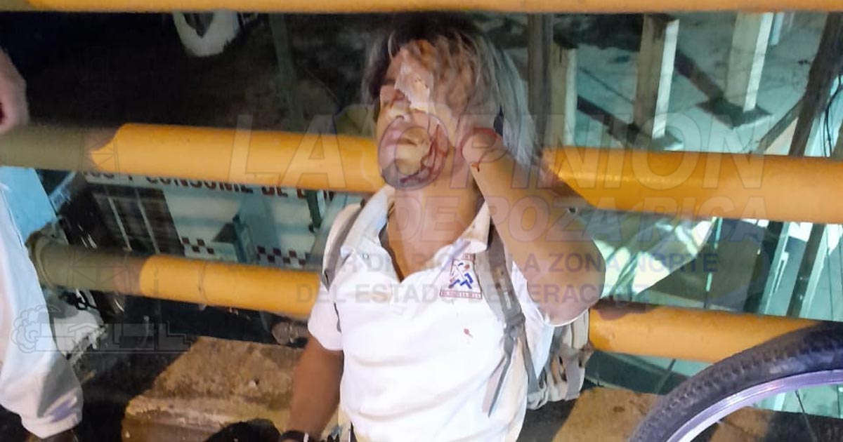 Ciclistas chocan en el puente