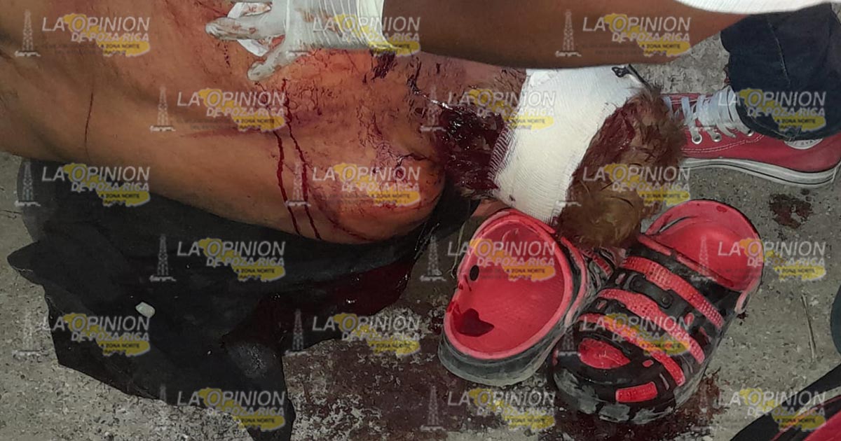 Jornalero atacado a machetazos