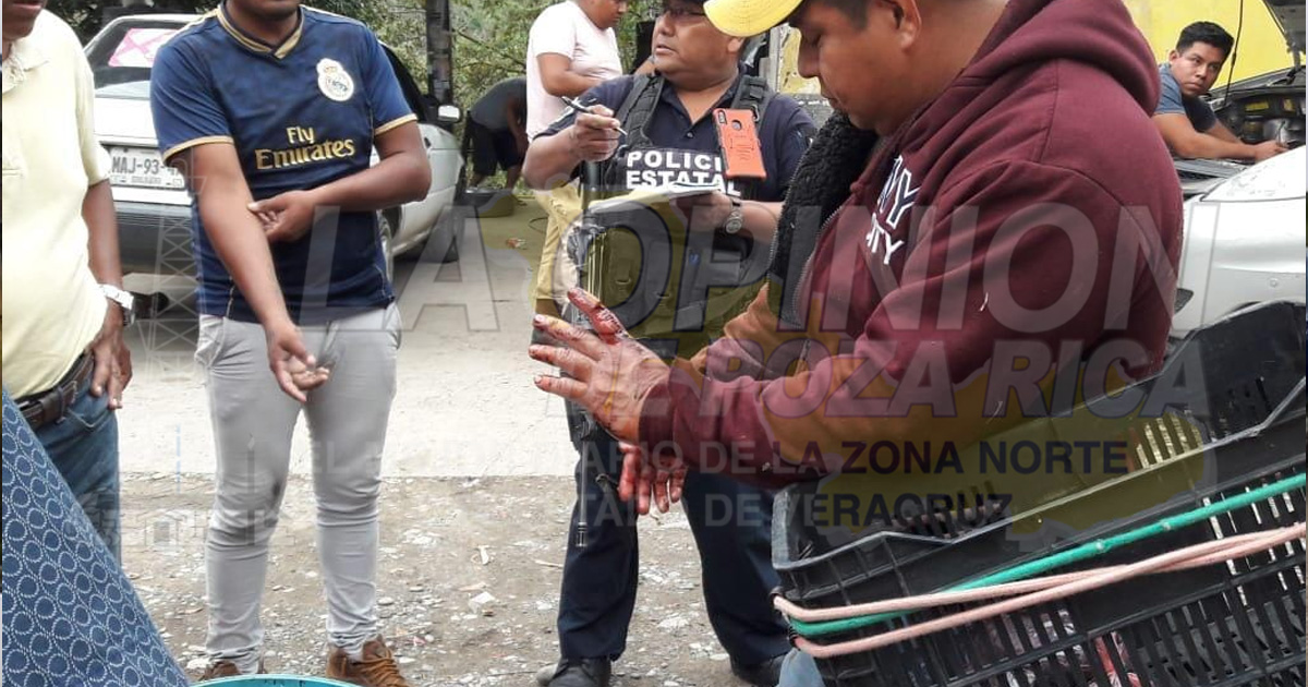 Escolta del presidente de Coxquihui arrolla a motociclista