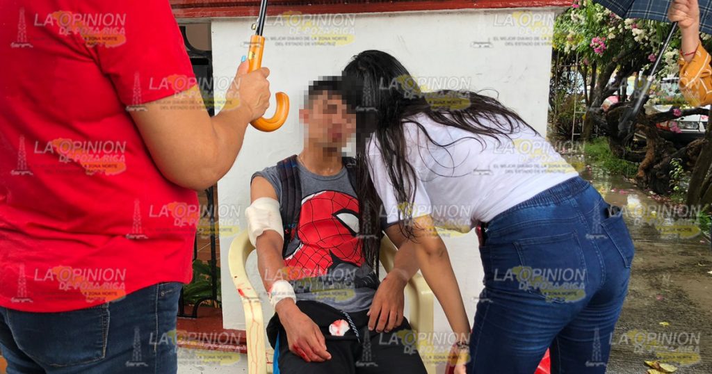 Dos lesionados en brutal choque en Poza Rica